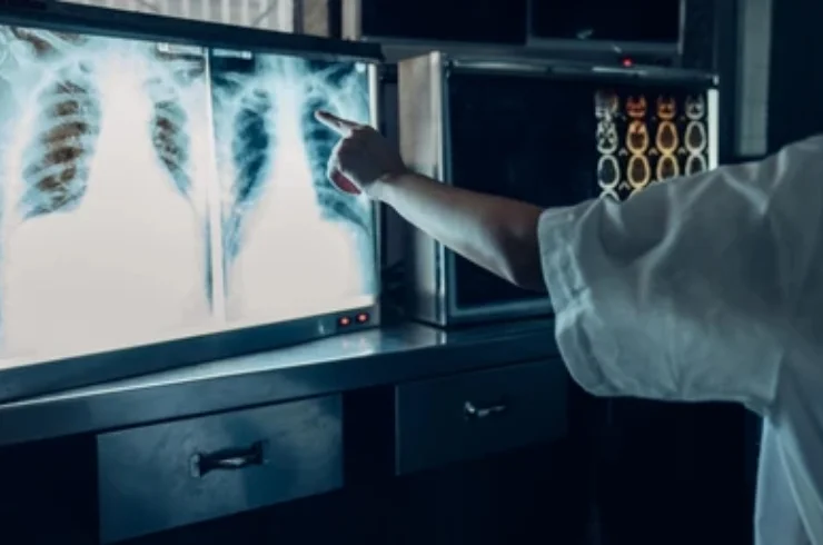Digital X-ray